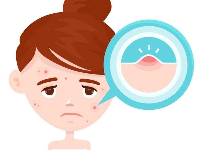 11 tuổi có kinh nguyệt có sao không