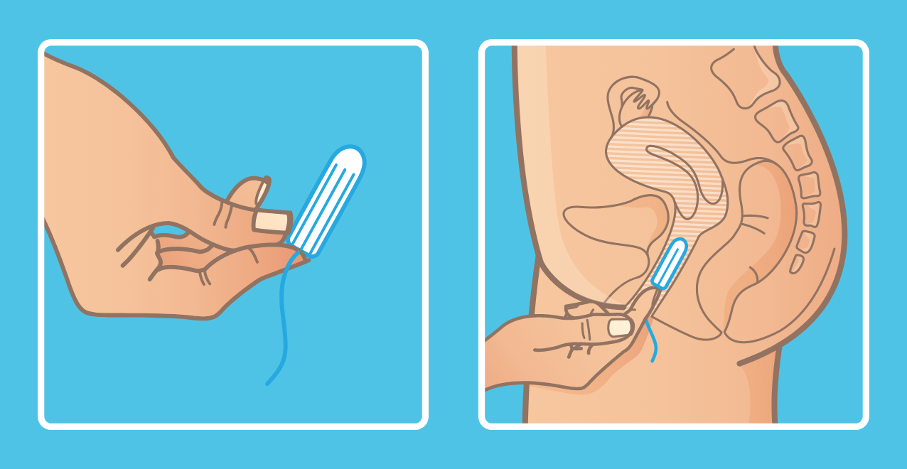 Cách sử dụng tampon