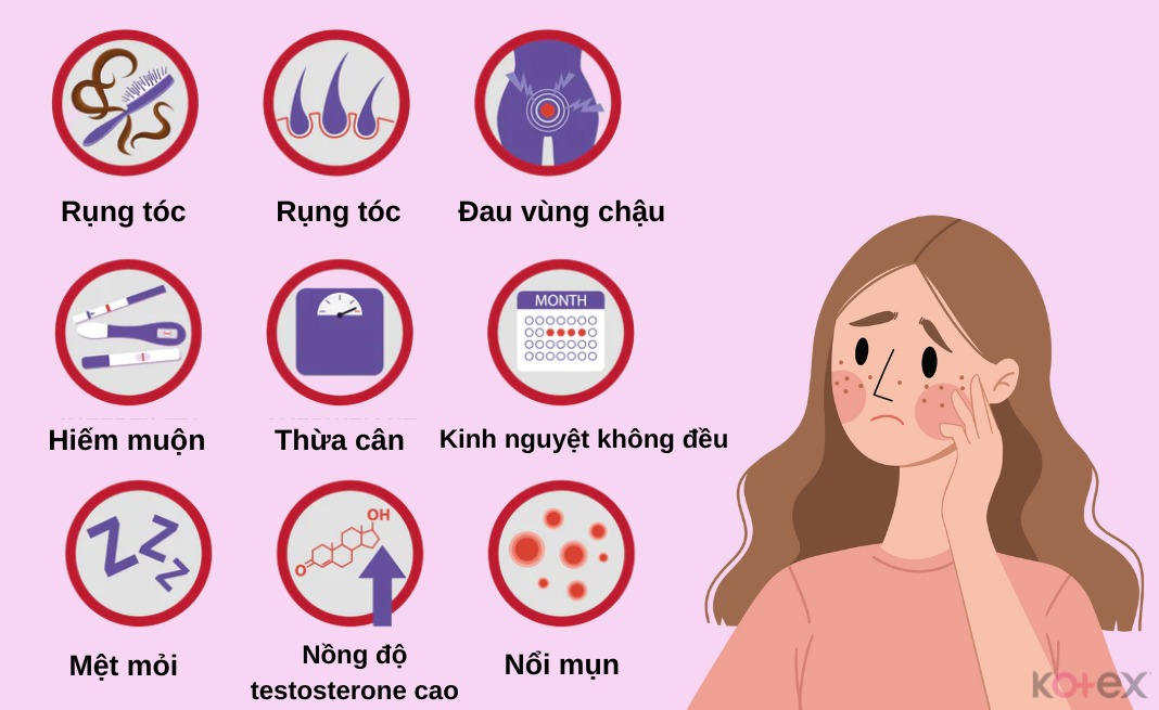 buồng trứng đa nang
