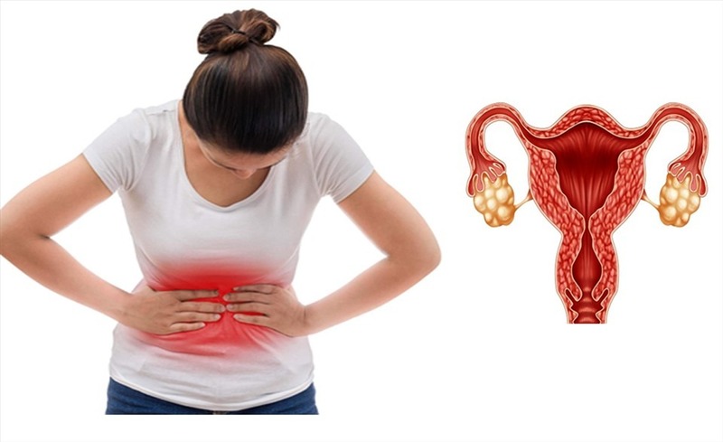 buồng trứng đa nang có rụng trứng không