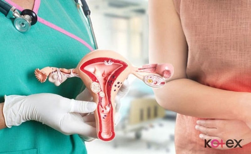 cách trị kinh nguyệt ra ít tại nhà kinh nguyệt ra ít nên uống thuốc gì