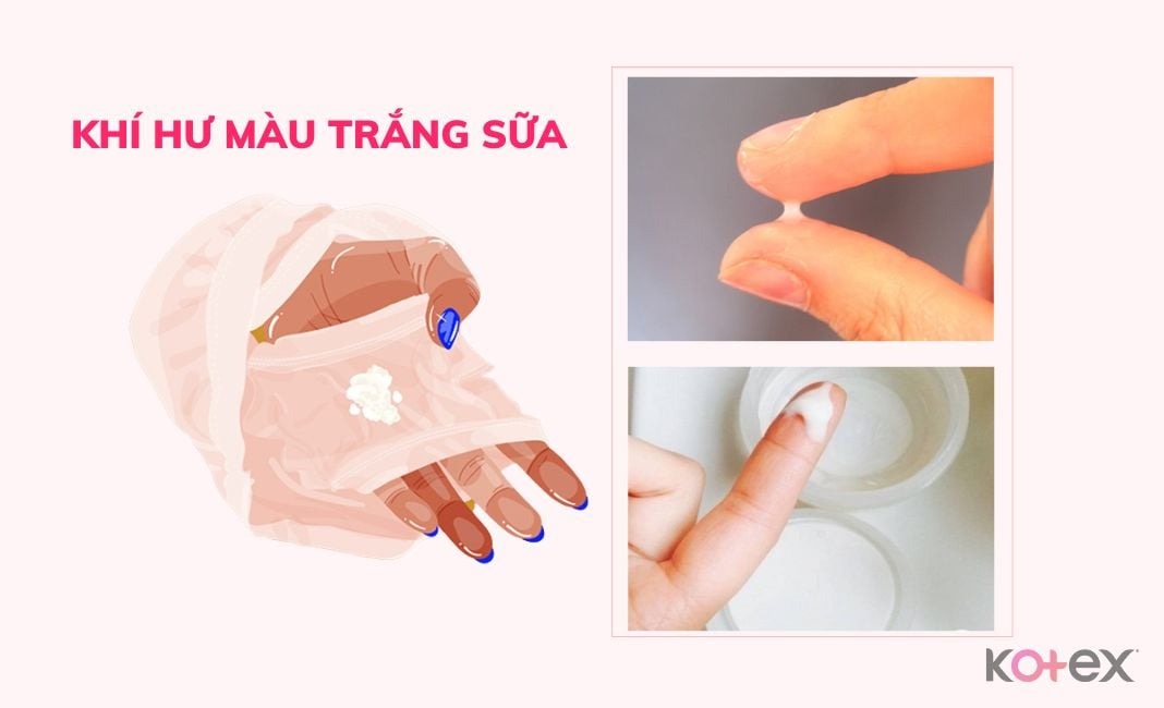 chậm kinh ra khí hư màu trắng sữa