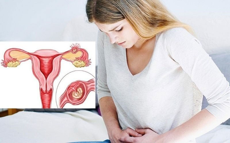 chưa đến kỳ kinh nhưng ra máu hồng