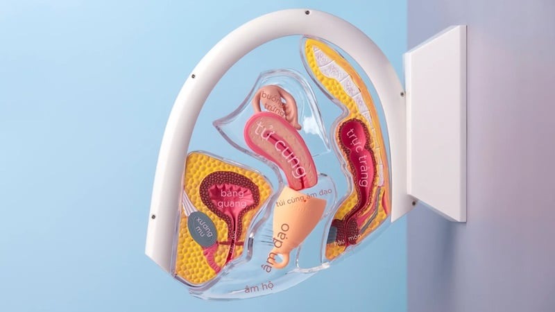 cốc nguyệt san bị tụt vào trong