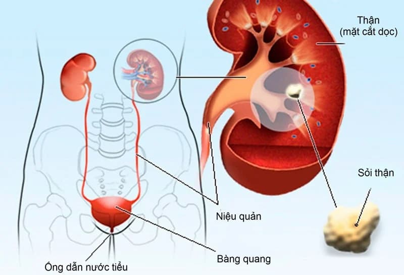 đau bụng dưới và đau lưng nhưng không có kinh