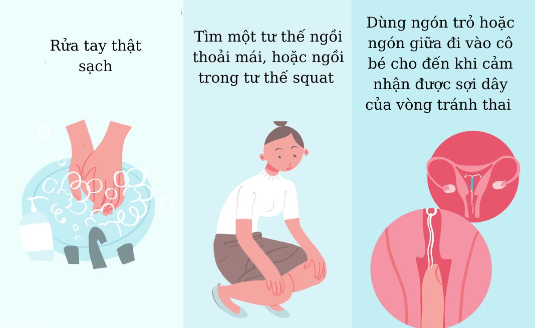 dấu hiệu lệch vòng tránh thai