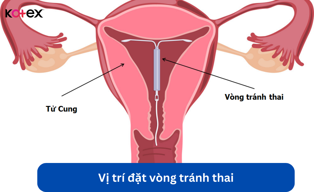 hết kinh 4 ngày quan hệ có thai không
