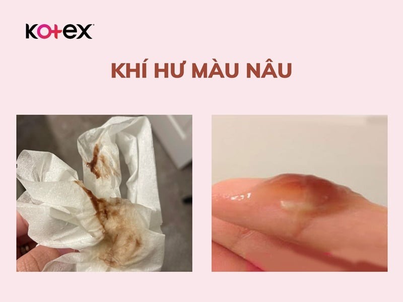 khí hư màu nâu