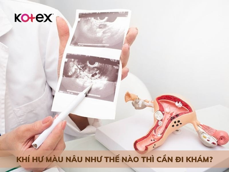 khí hư màu nâu