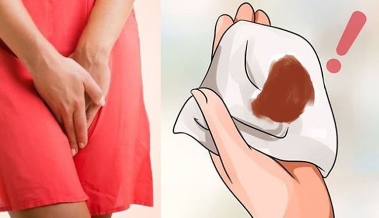 khí hư màu nâu sau kỳ kinh nguyệt 1 tuần
