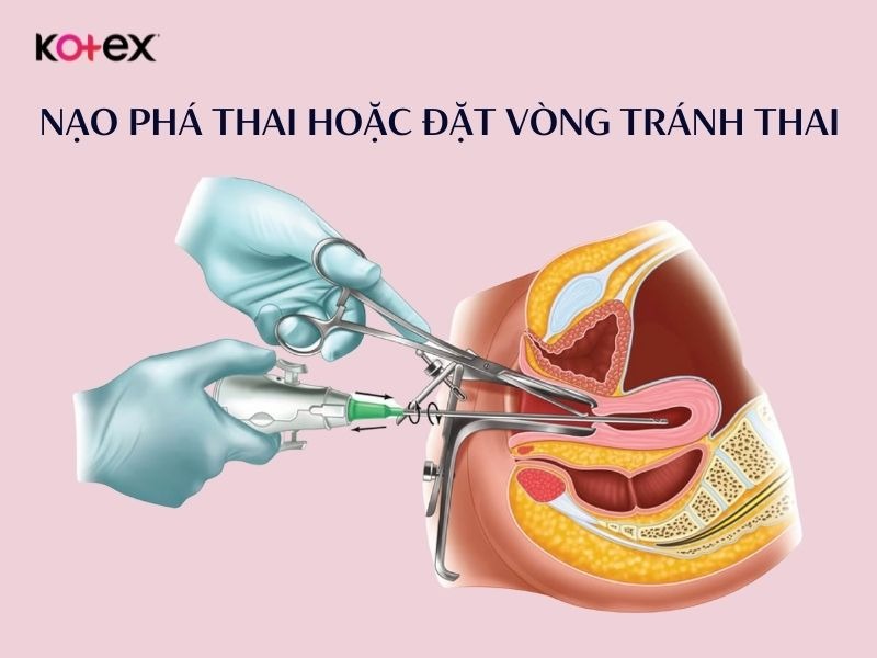 khí hư màu vàng