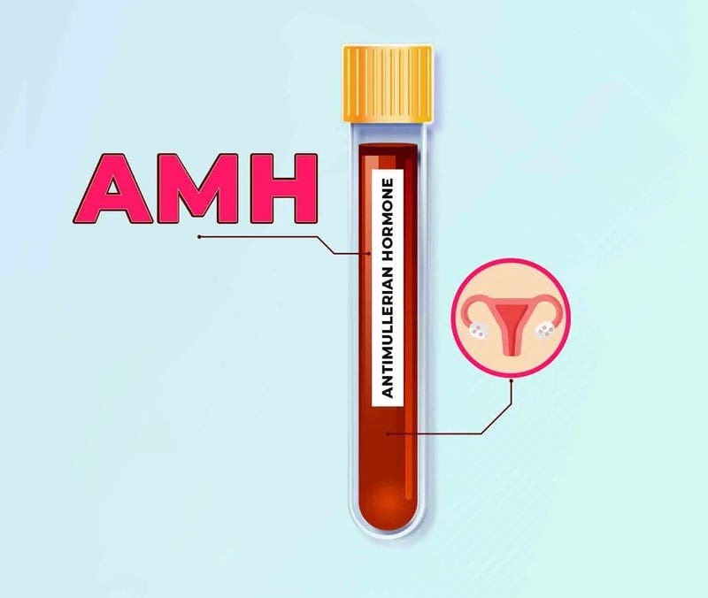 kinh nguyệt đều nhưng amh thấp