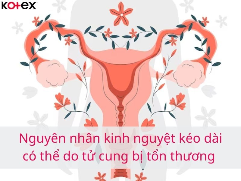 kinh nguyệt kéo dài
