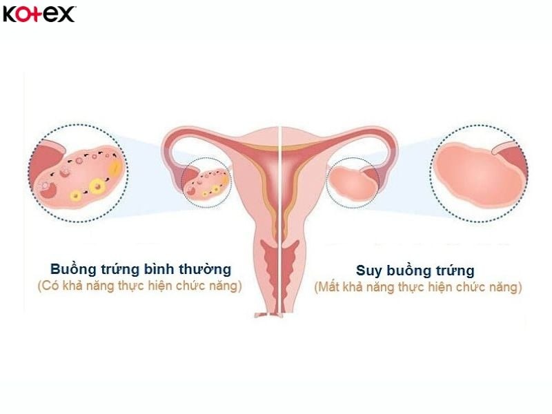 kinh nguyệt màu nâu