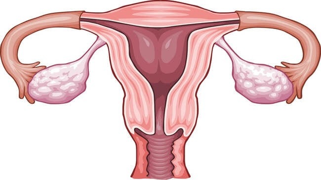 kinh nguyệt ra cục thịt