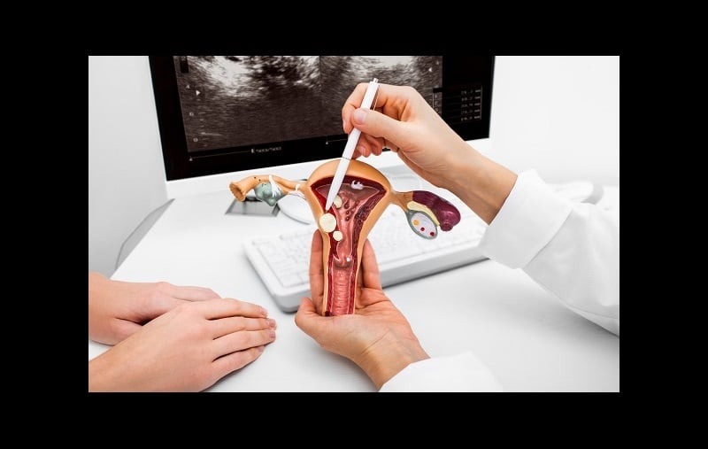 làm sao để kinh nguyệt đều