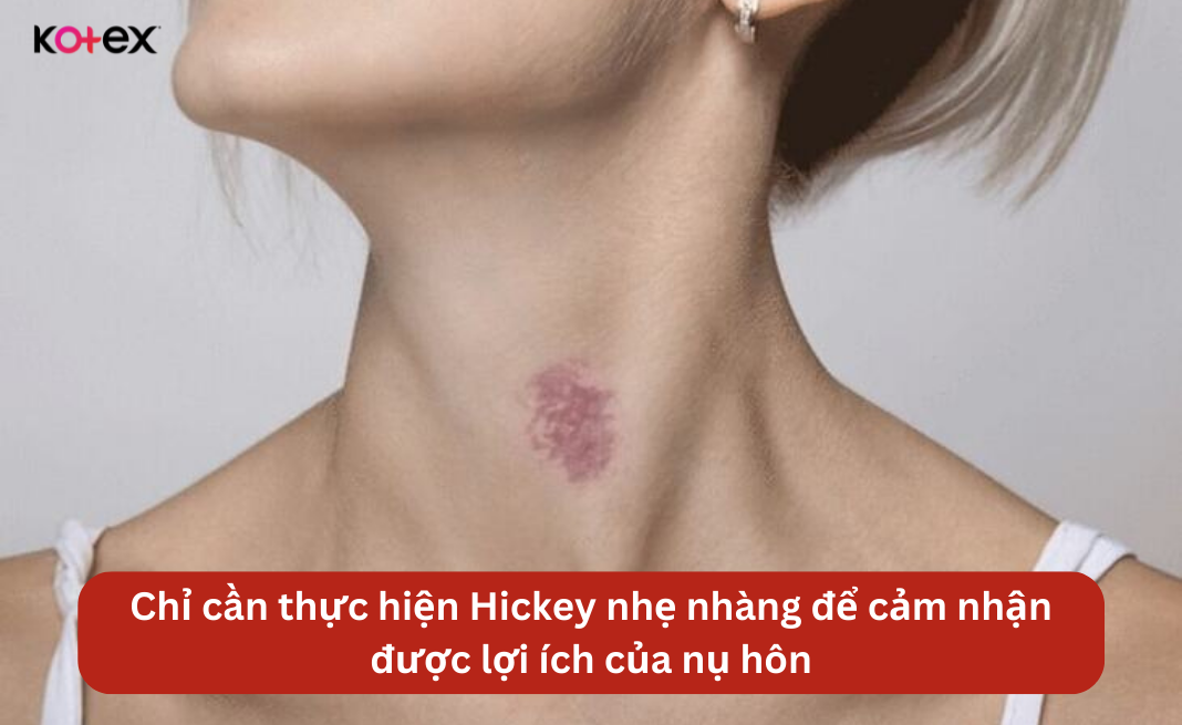 lợi ích của hôn