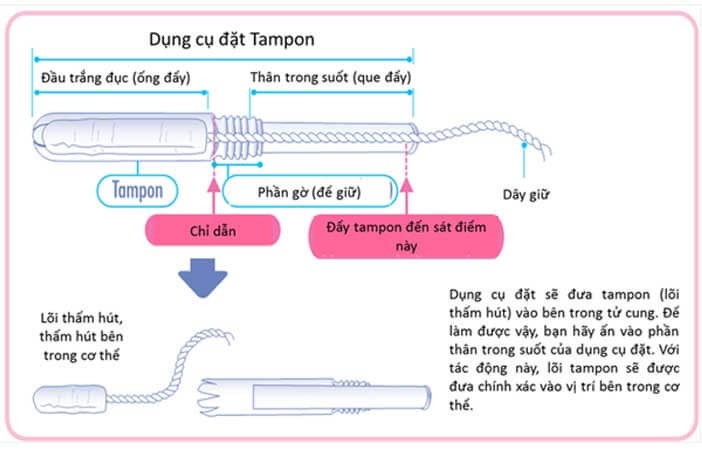 mách bạn cách dùng băng vệ sinh không bị tràn trong ngày đền đỏ