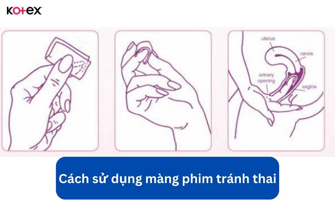 màng phim tránh thai