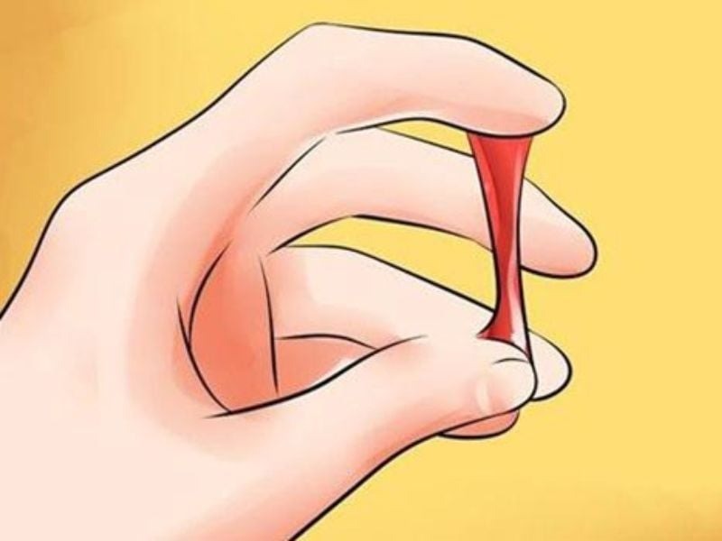 máu kinh nguyệt nhớt