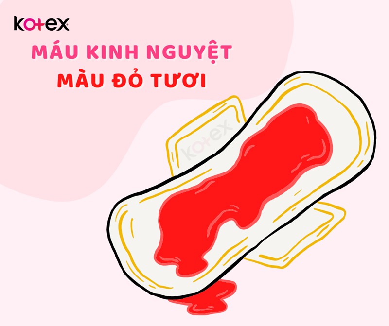 màu máu kinh nguyệt như thế nào là bình thường