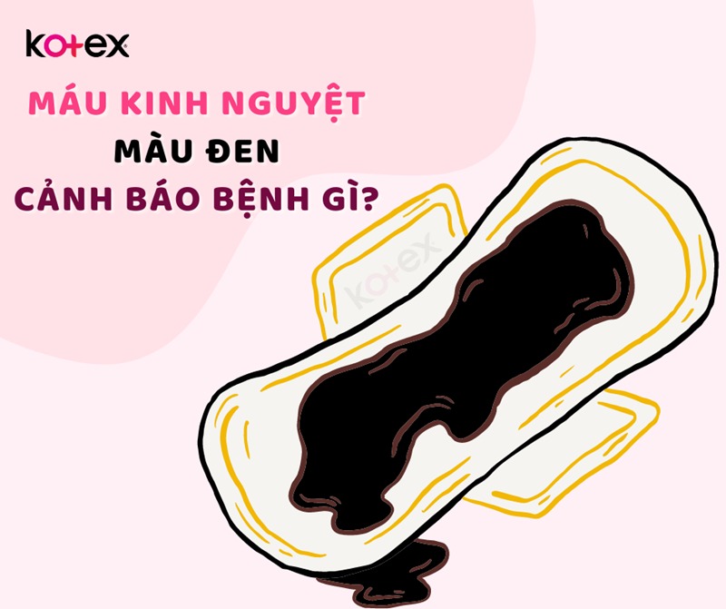 màu máu kinh nguyệt như thế nào là bình thường