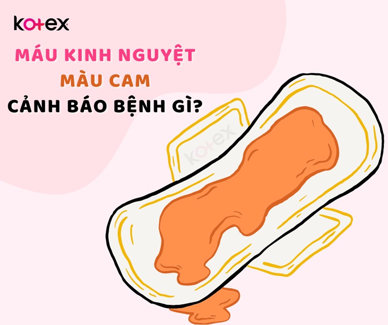 màu máu kinh nguyệt như thế nào là bình thường