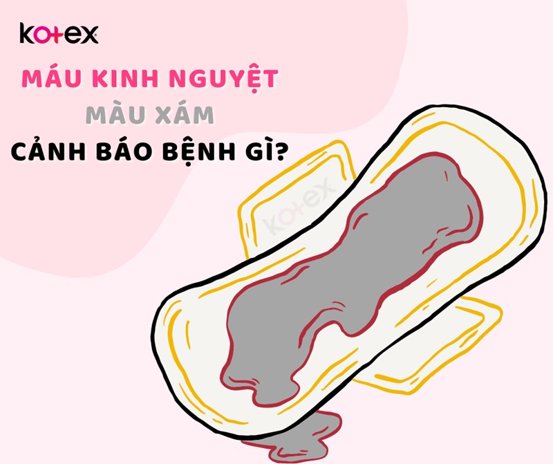 màu máu kinh nguyệt như thế nào là bình thường