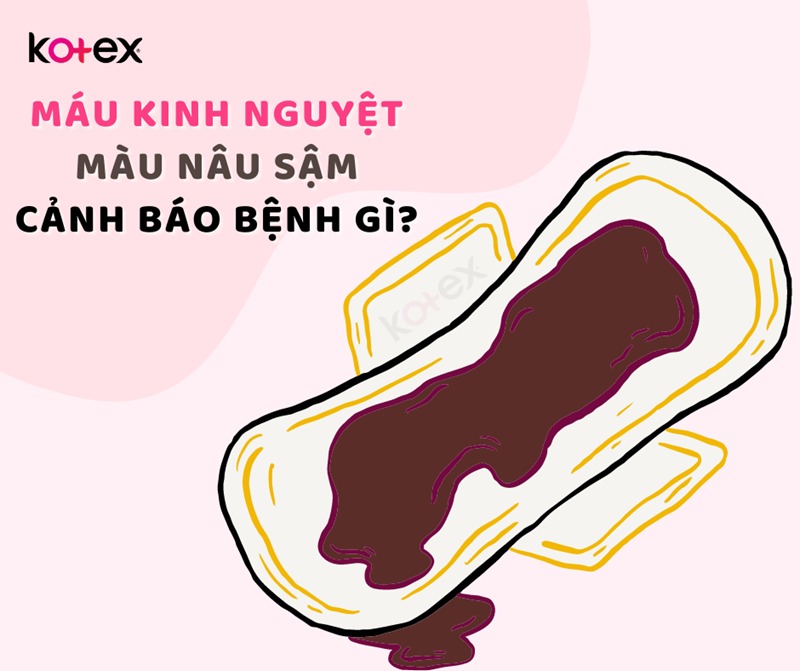 màu máu kinh nguyệt như thế nào là bình thường