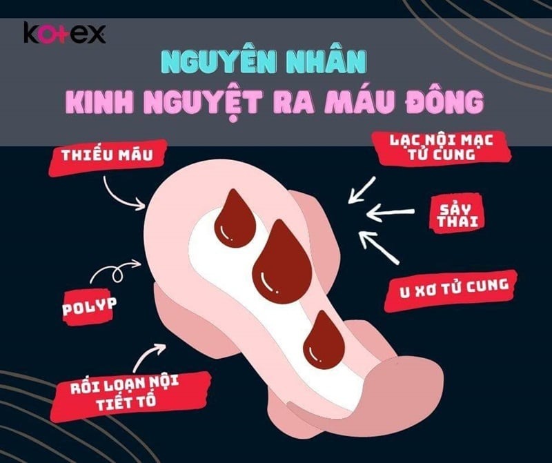 màu máu kinh nguyệt như thế nào là bình thường