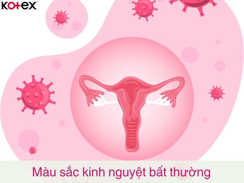 màu máu kinh nguyệt như thế nào là bình thường