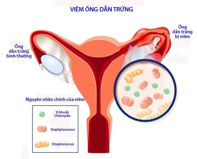 nóng sốt khi hành kinh