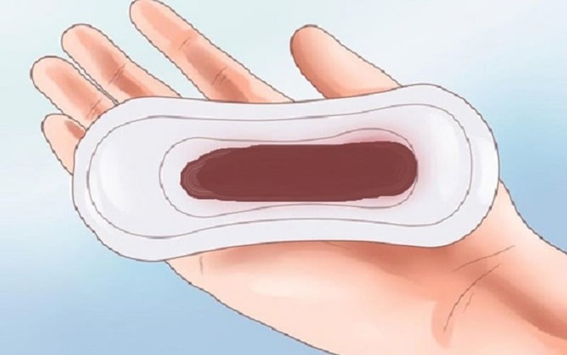 ra khí hư màu nâu trước kinh nguyệt