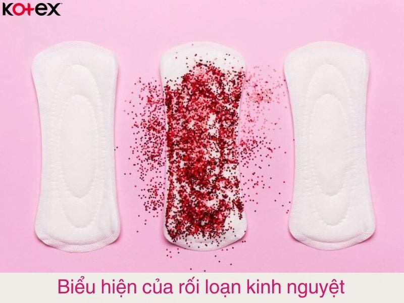 rối loạn kinh nguyệt
