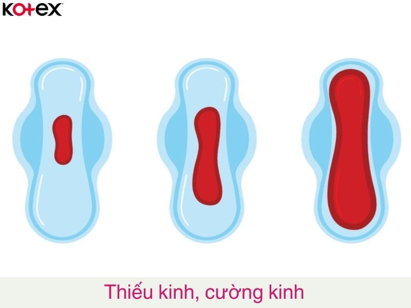 rối loạn kinh nguyệt