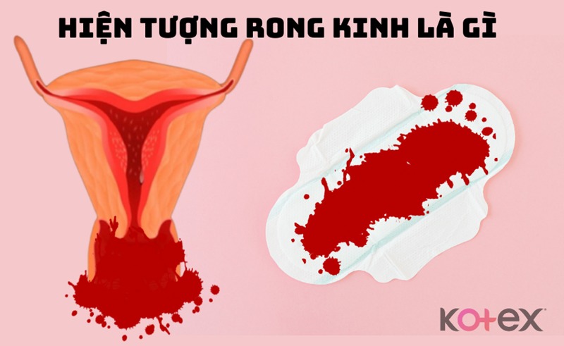 rong kinh là gì