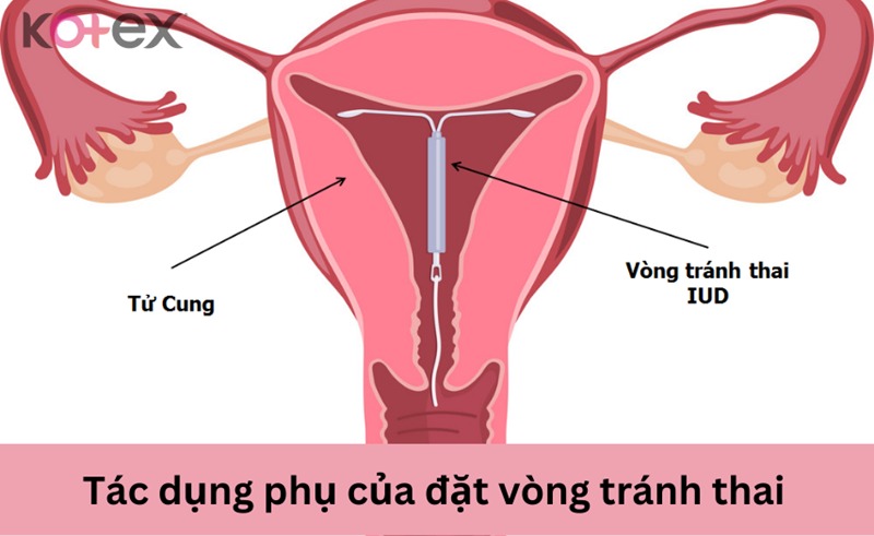 rong kinh là gì