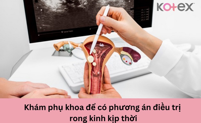 rong kinh là gì