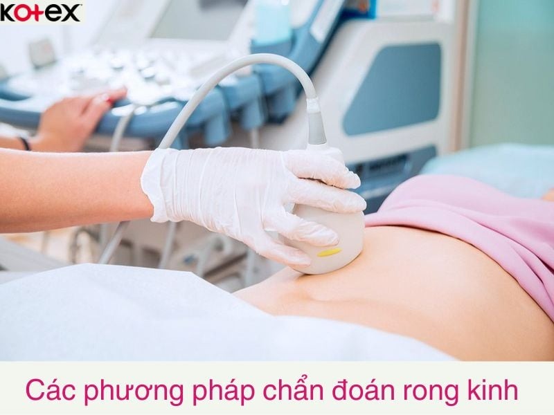 rong kinh là gì