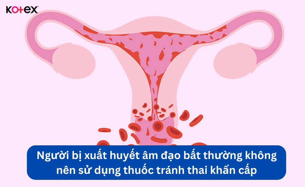 tác dụng phụ của thuốc tránh thai khẩn cấp
