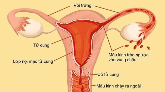 tác hại của cốc nguyệt san