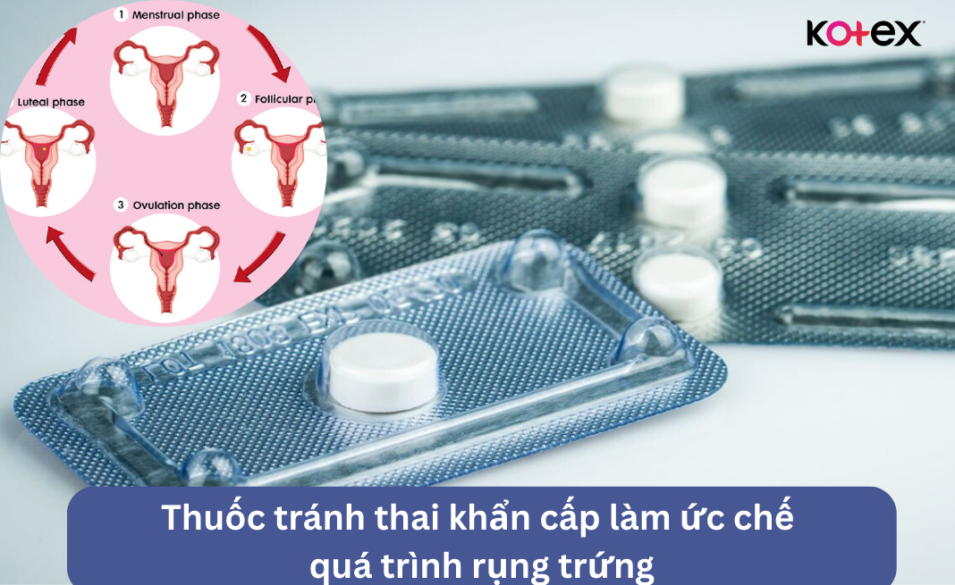 uống thuốc tránh thai khẩn cấp bị trễ kinh