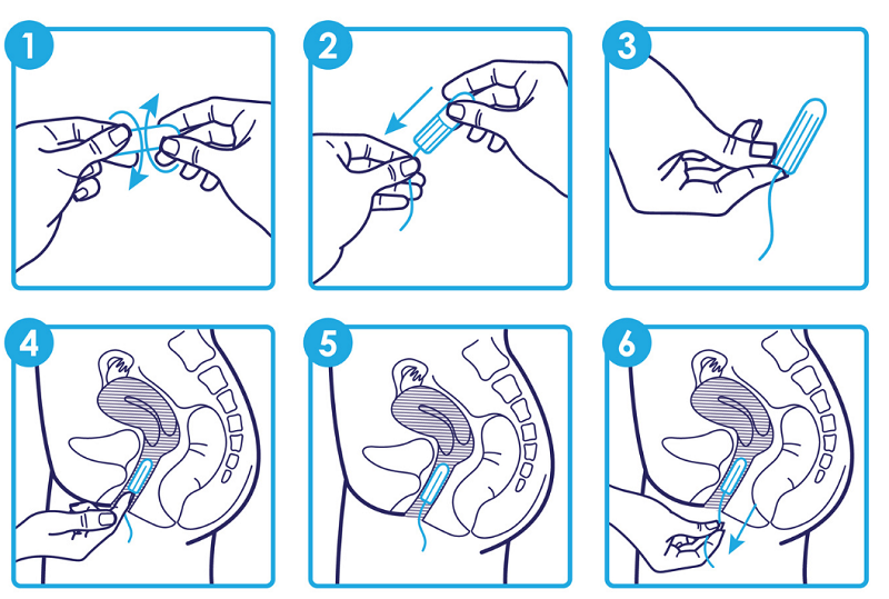 băng vệ sinh dạng ống tampon