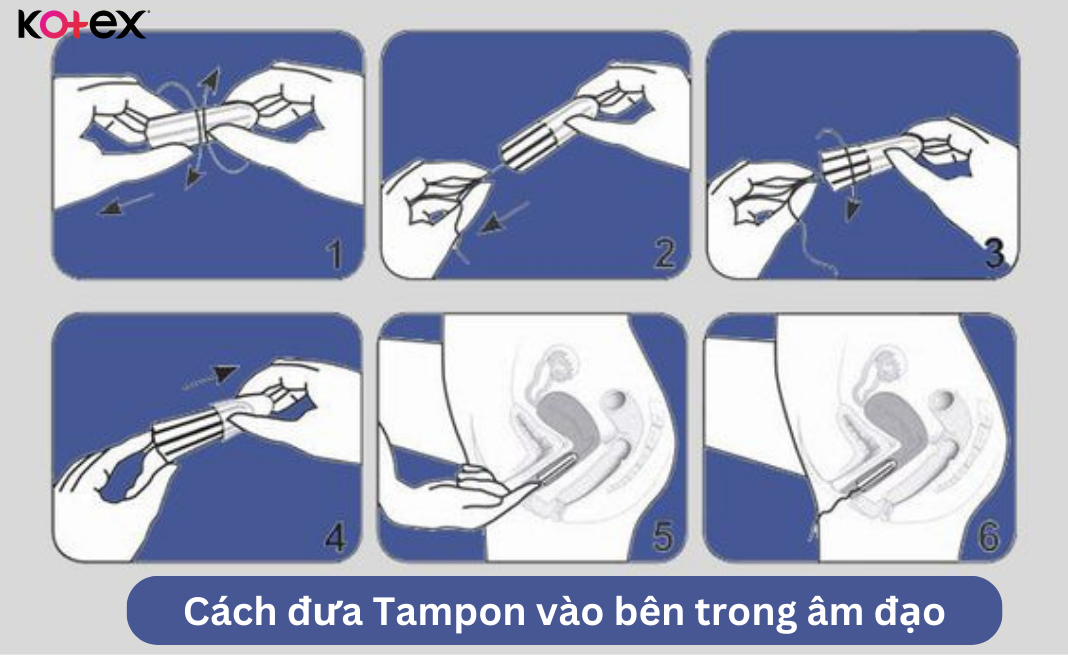 Cách đưa Tampon vào bên trong âm đạo 