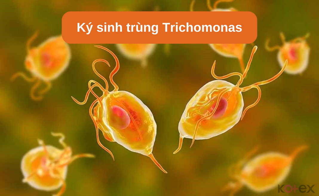 Viêm nhiễm âm đạo do trùng roi (Trichomonas) gây khí hư có mùi hôi