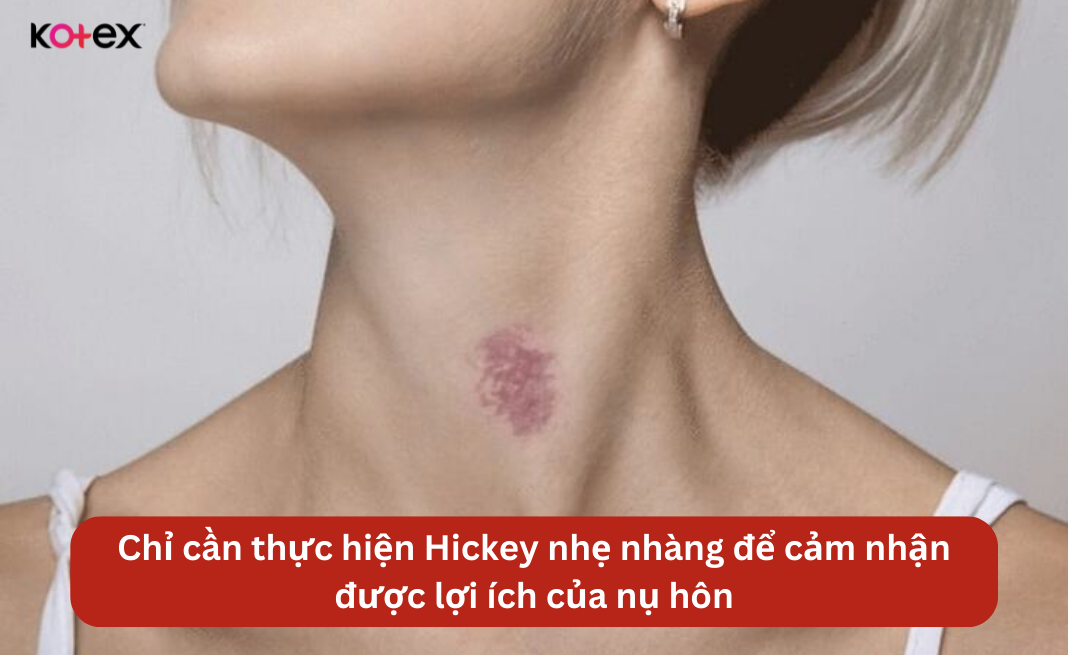 Chỉ cần thực hiện Hickey nhẹ nhàng để cảm nhận được lợi ích của nụ hôn